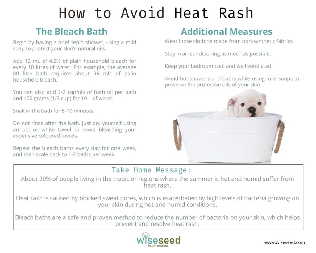 How To Avoid Heat Rash Infographic