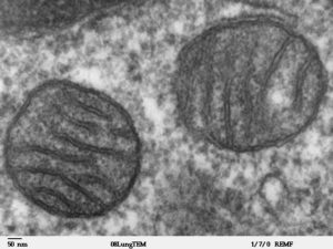 Mitochondria Mammalian Lung Tem